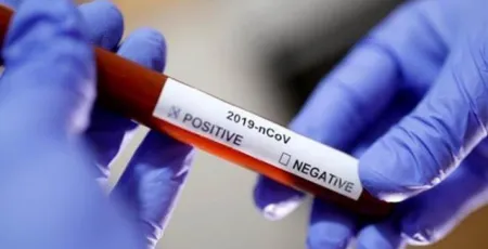 क्वारेन्टिनमा आत्महत्या गरेका अछामका युवकको कोरोना रिपोर्ट पोजेटिभ